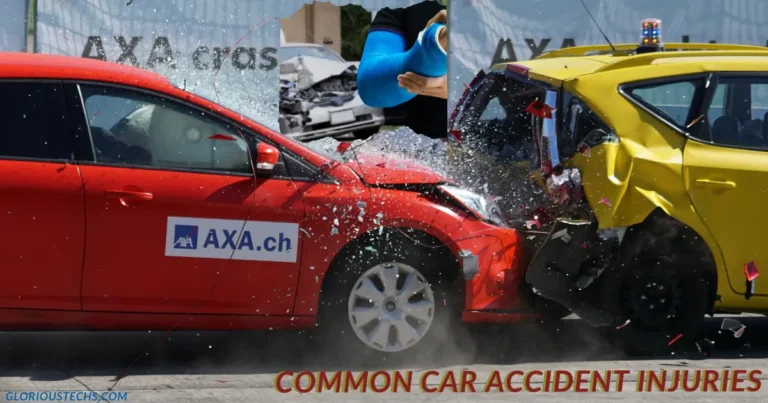 Common Car Accident Injuries